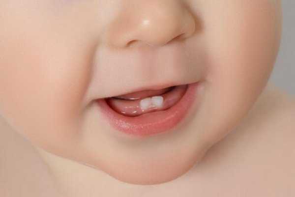 Οδοντικός-πόνος-στο-μωρό:-Γιατί-συμβαίνει-και-πώς-να-το-ανακουφίσετε
