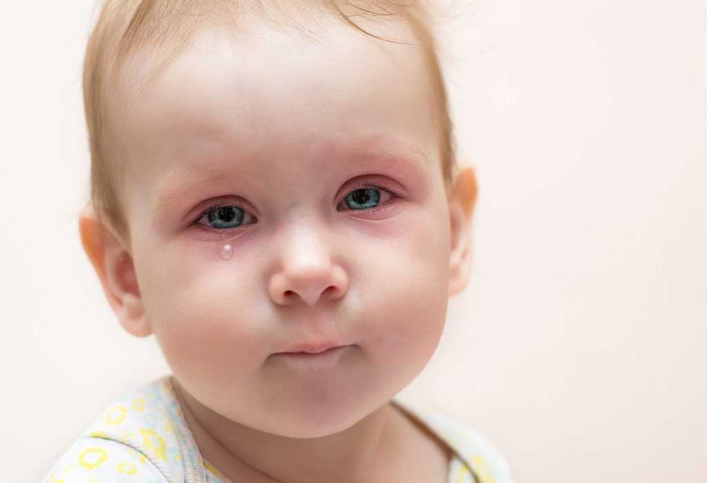 Επιπεφυκίτιδα-στα-μωρά:-Πώς-να-το-αντιμετωπίσετε