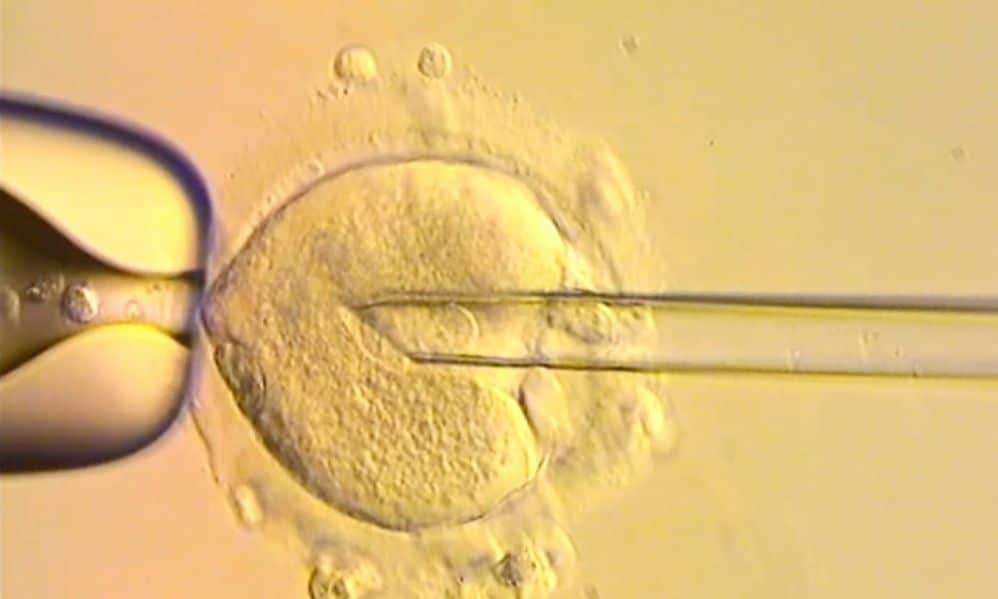 Βρετανία:-Γεννήθηκαν-μωρά-από-dna-τριών-ατόμων-–-Είναι-απαλλαγμένα-από-μιτοχονδριακά-νοσήματα